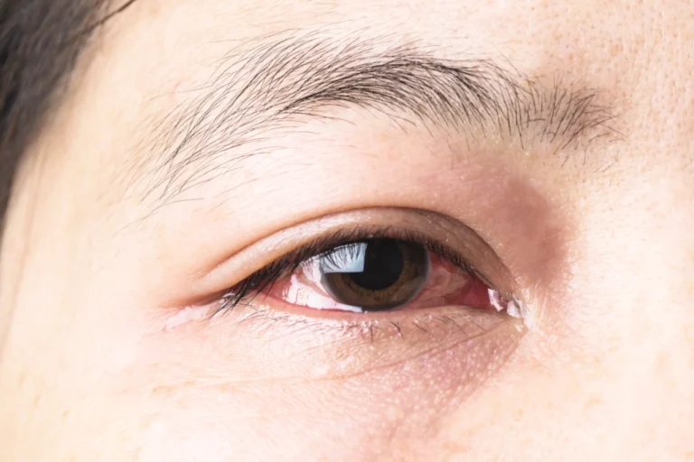 Eye Health & Natural Treatment at House of Nature Medical Center in Abu Dhabi