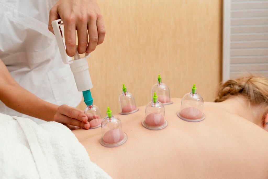 Hijama Cupping Therapy at House of Nature Medical Center in Abu Dhabi