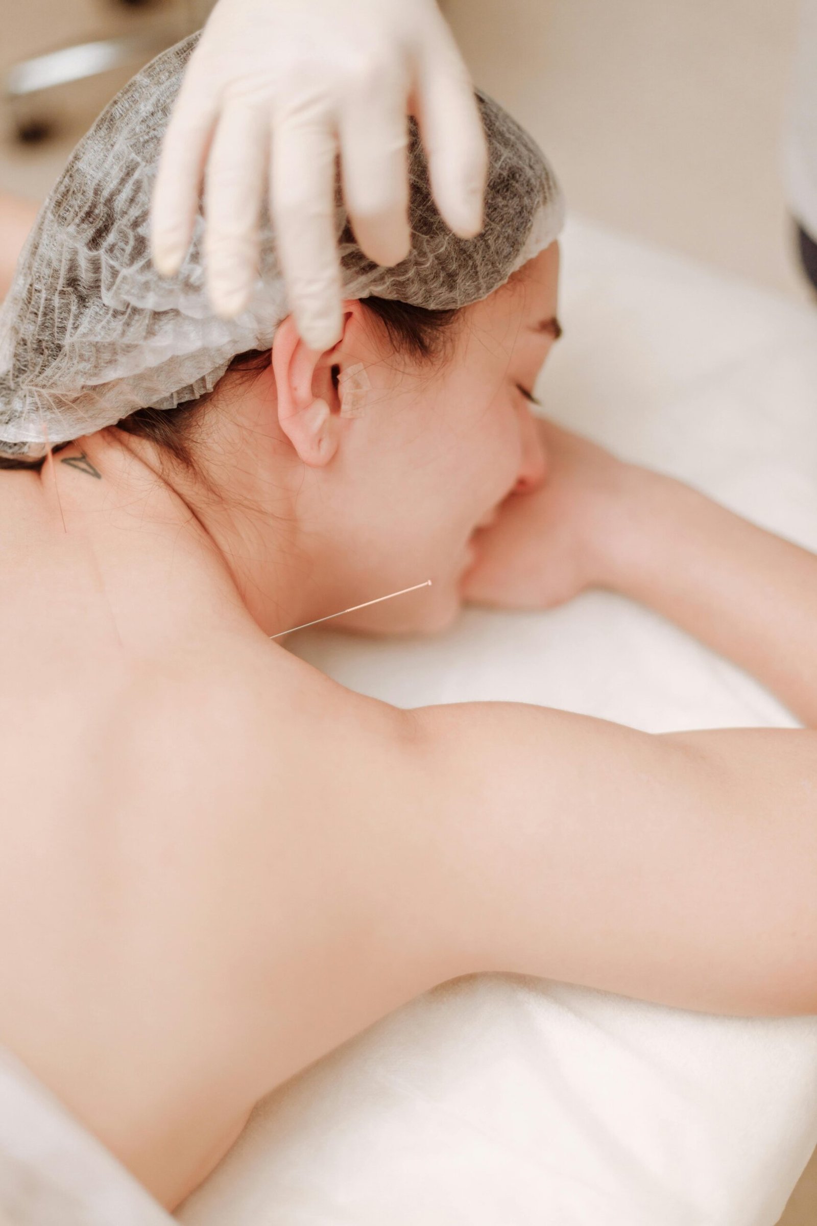 acupunture at House of Nature Medical Center in Abu Dhabi