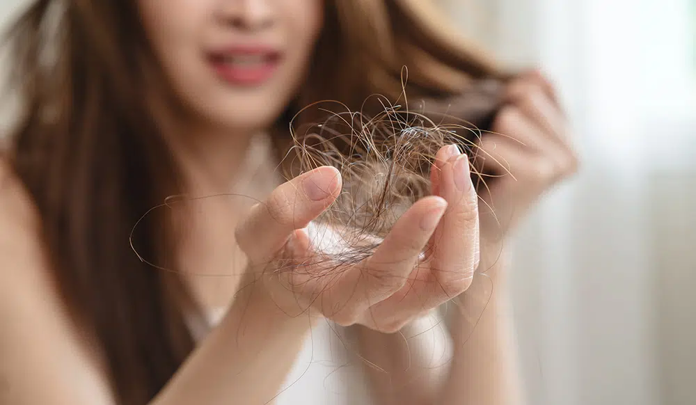 Hair loss Treatment in Abu Dhabi