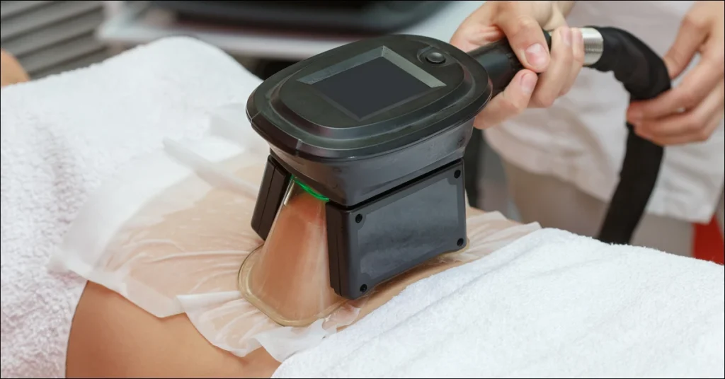 The Science of Cryolipolysis