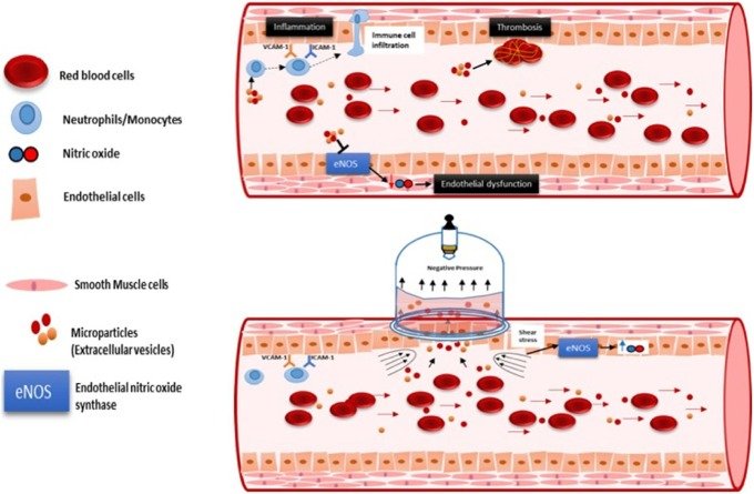 Reducing Inflammatory Markers