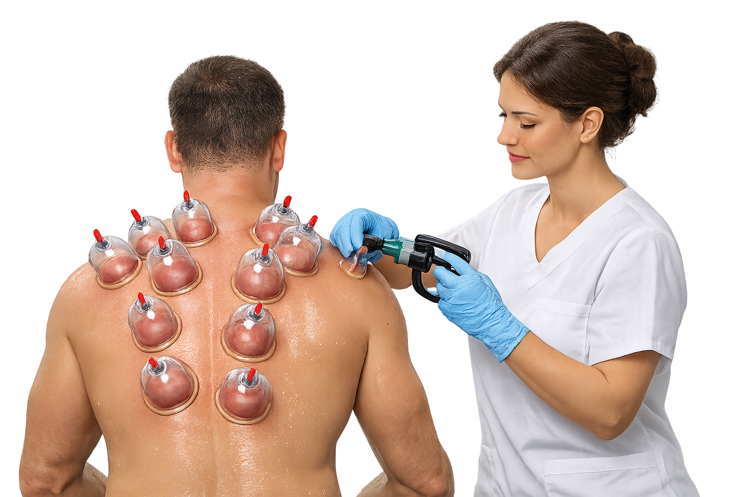 Cupping Therapy
