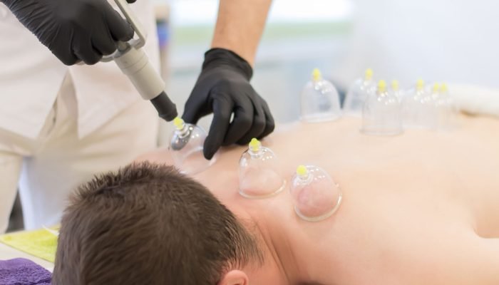 Dry Cupping Therapy at House of Nature in Abu Dhabi