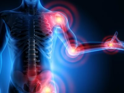 musculoskeletal-disorders Musculoskeletal Disorders solutions at House of Nature Medical Center In Abu Dhabi for Alternative Medicine