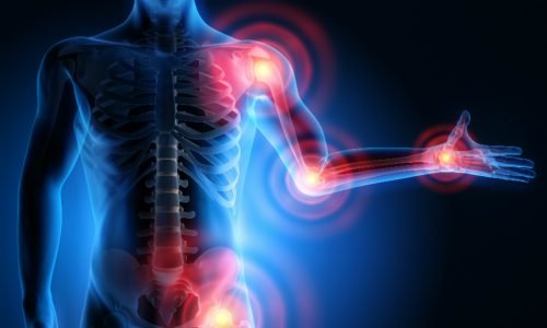 musculoskeletal-disorders Musculoskeletal Disorders solutions at House of Nature Medical Center In Abu Dhabi for Alternative Medicine