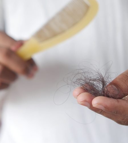 A detailed image showing hair loss with a comb in hand, symbolizing alopecia and related issues.